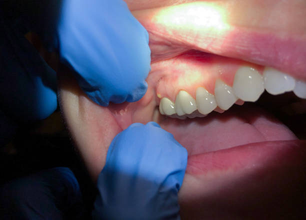 Best Walk-In Emergency Dental Services in Bells, TX