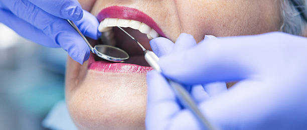 Best Emergency Wisdom Tooth Extraction in Bells, TX